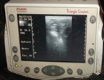karens scanner